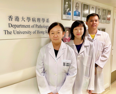Dr Judy Yam Wai-ping, Associate Professor of the Department of Pathology, HKUMed (left), with her research team members, Dr Tey Sze-keong, Post-doctoral Fellow (right) and Ms Cherlie Yeung Lot-sum, Research Assistant (middle).
 
